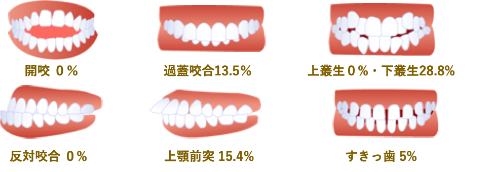 不正咬合別 咬合異常の早期治療入門 - クインテッセンス出版 - 健康・医学