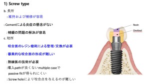 スクリュータイプの長所と短所