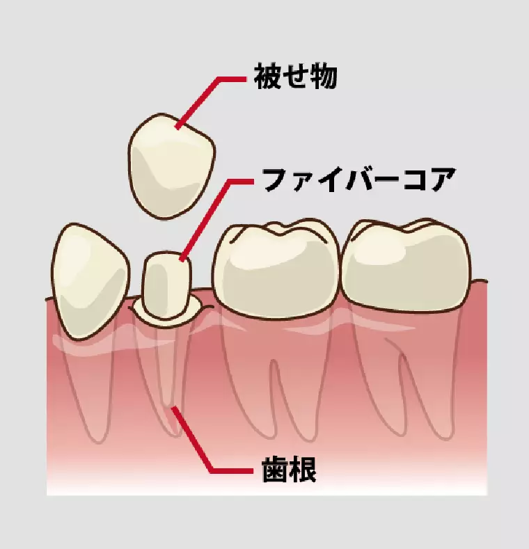 ファイバーコアについて