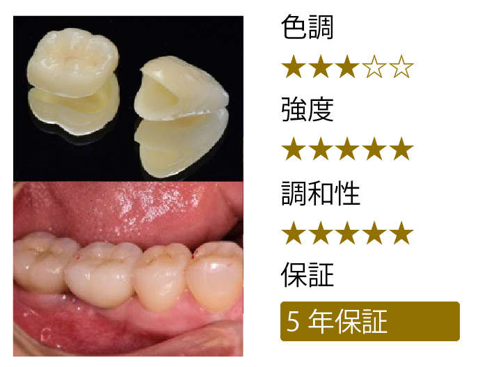 ジルコニアクラウン（生活歯）（ステインなし）