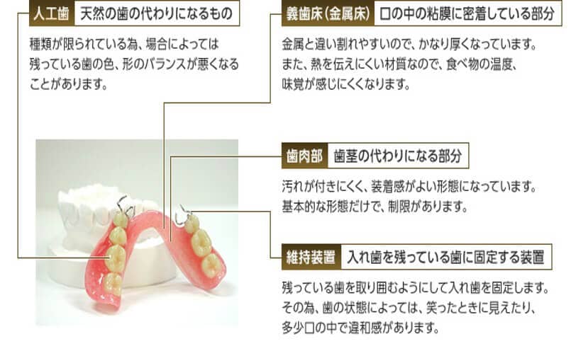 保険適用の入れ歯