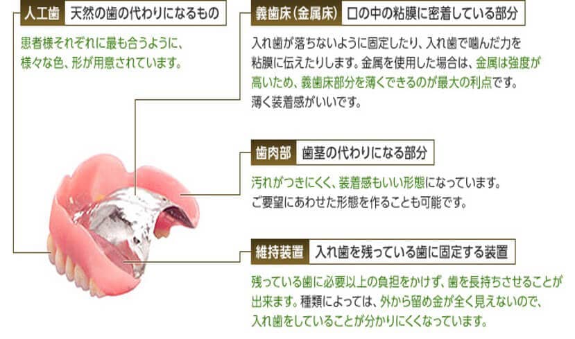 自費負担の入れ歯