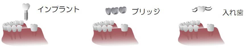 従来の治療法との違い