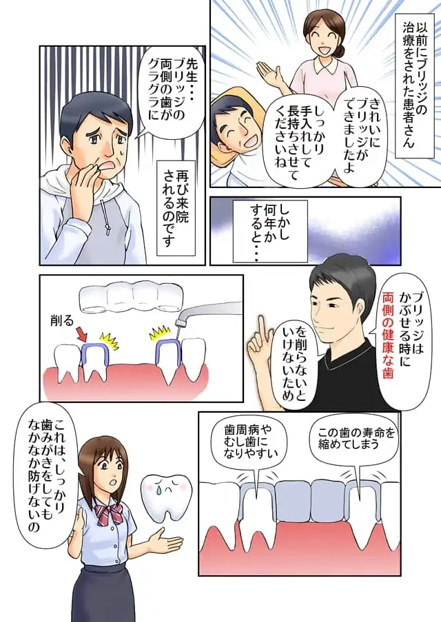 まんがで解説！「インプラント治療」