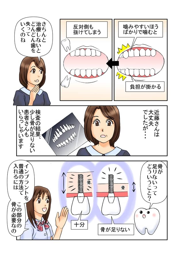 まんがで解説！「インプラント治療」