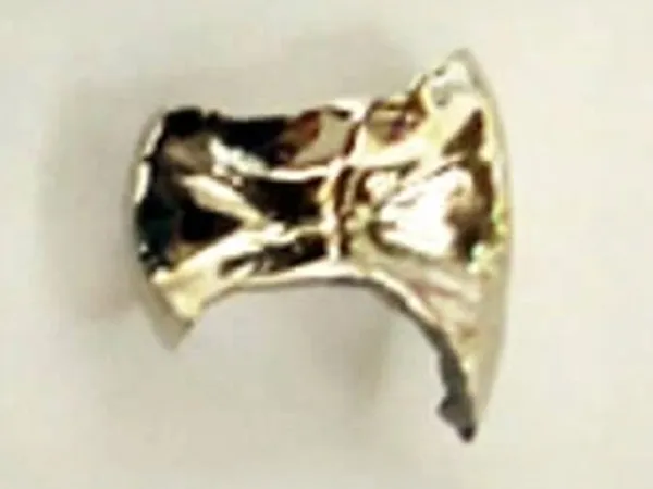 ゴールドインレー