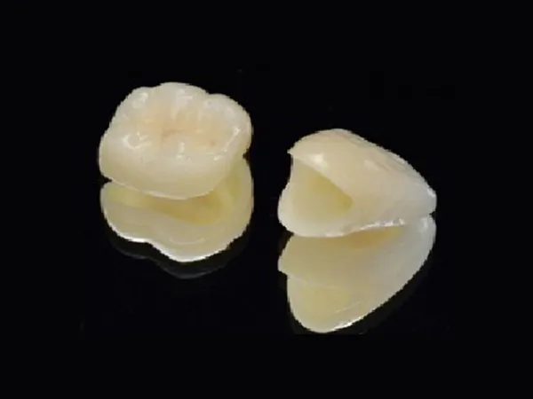 ジルコニアクラウン（ステインなし）