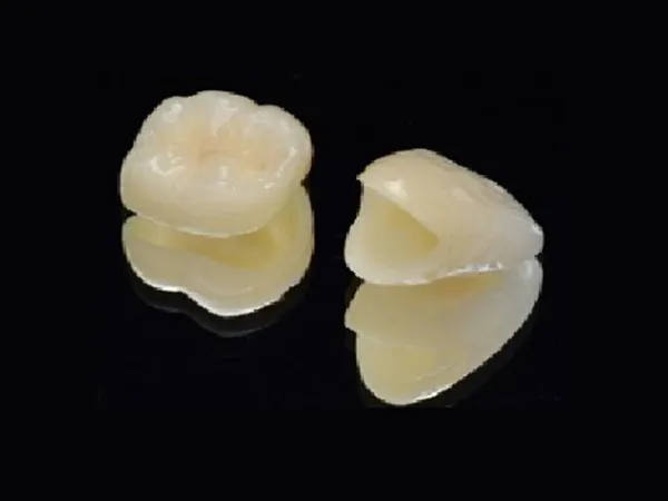 ジルコニアクラウン（ステインあり）