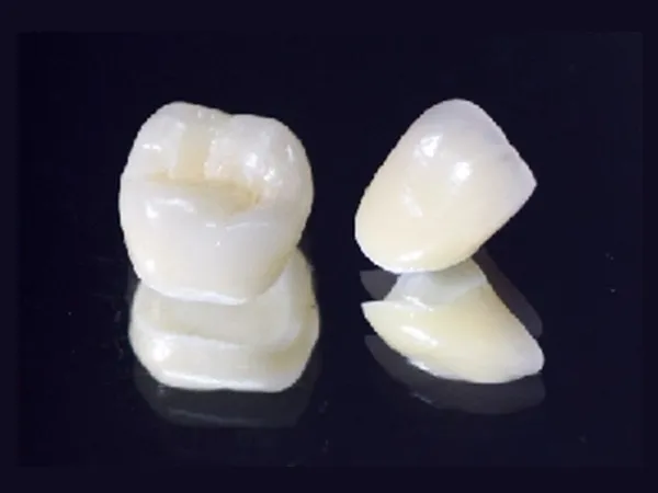 ハイクラスセラミッククラウン