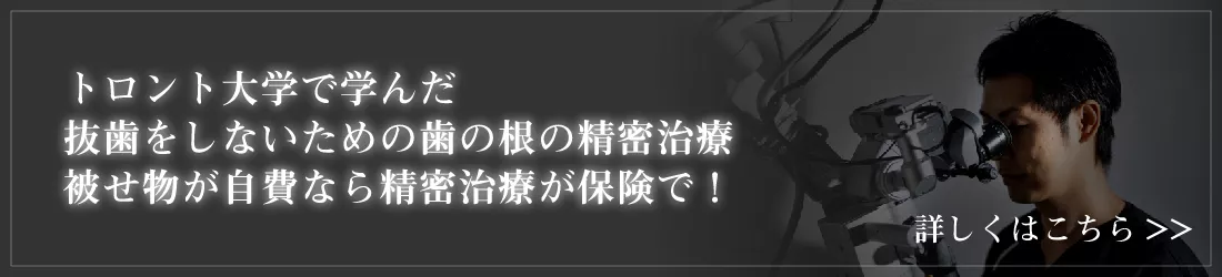 インプラント治療はとても優れた治療ですがあくまで治療方法の選択肢の一つ。